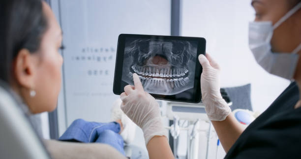 Best Broken or Chipped Tooth Repair in USA